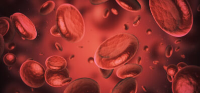 La Anemia es un Riesgo para la Salud Auditiva